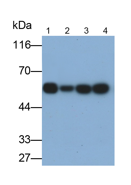 微管蛋白α1C(TUBa1C)多克隆抗体