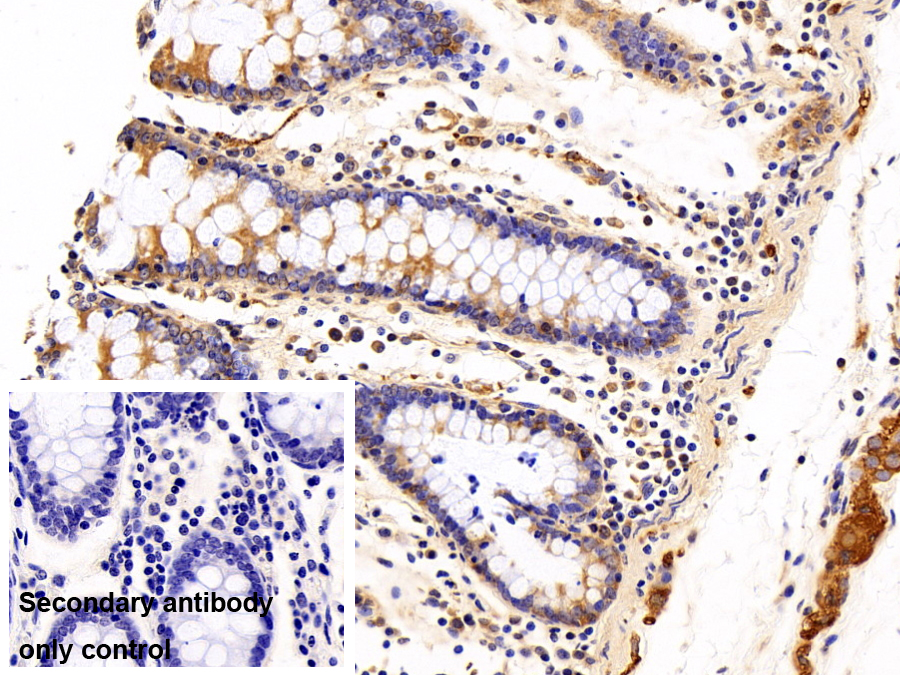 微管蛋白α1C(TUBa1C)多克隆抗體