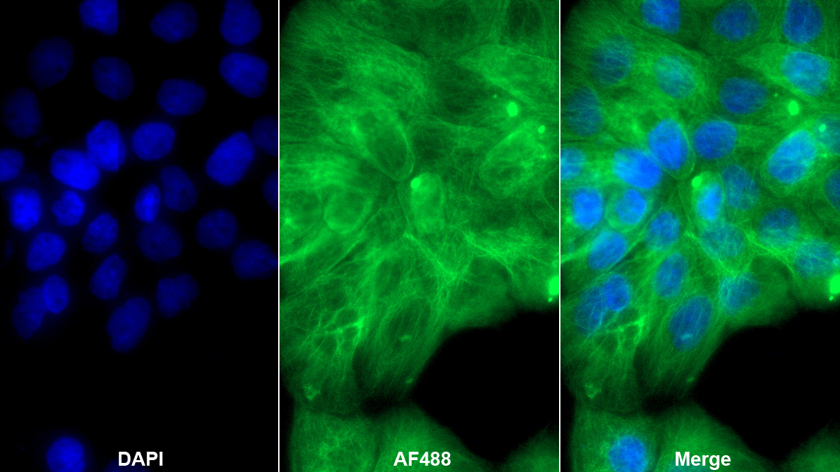 微管蛋白α1C(TUBa1C)多克隆抗體