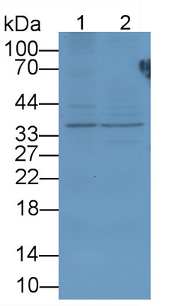 肽酶抑制因子16(PI16)多克隆抗体