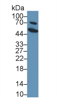 肽酶抑制因子16(PI16)多克隆抗体