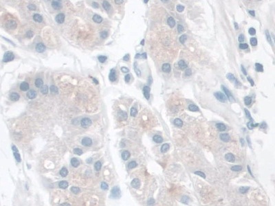 含LETM1域蛋白1(LETMD1)多克隆抗体