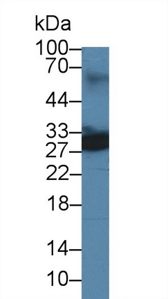 泛素羧基端酯酶L4(UCHL4)多克隆抗體