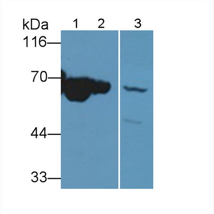 NADH脱氢酶5(ND5)多克隆抗体