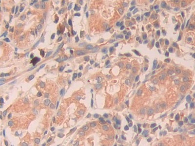 核糖核酸酶A11(RNASE11)多克隆抗体