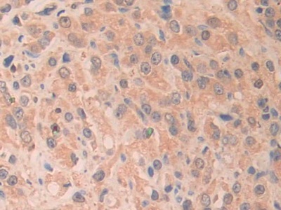 核糖核酸酶A11(RNASE11)多克隆抗体