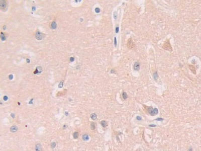 核糖核酸酶A11(RNASE11)多克隆抗体