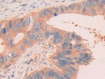 核糖核酸酶A11(RNASE11)多克隆抗体