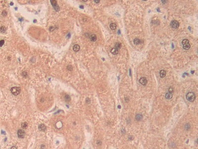 核糖核酸酶A11(RNASE11)多克隆抗体