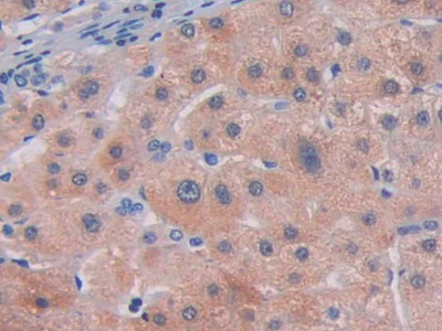 核糖核酸酶A13(RNASE13)多克隆抗体