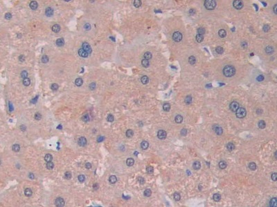 核糖核酸酶A13(RNASE13)多克隆抗体