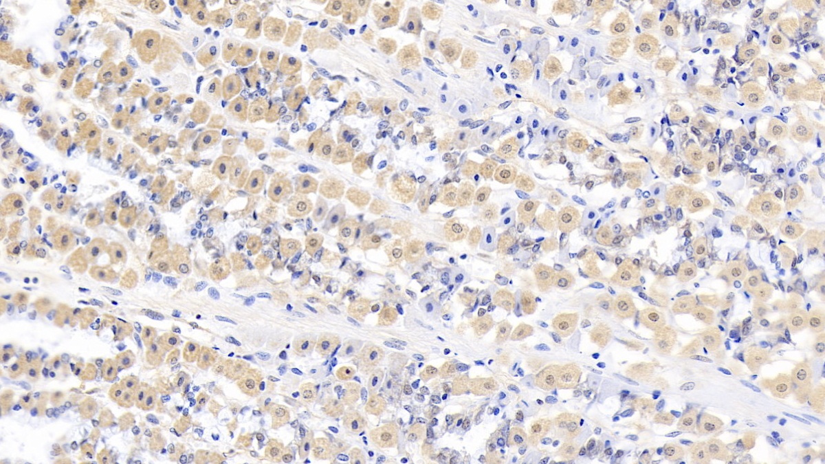 核糖核酸酶A13(RNASE13)多克隆抗体
