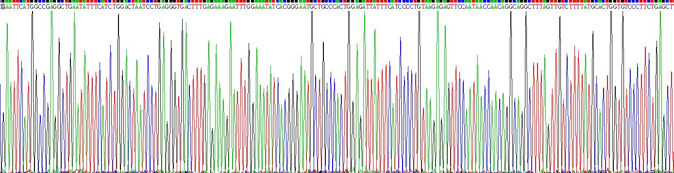 白介素8受体α(IL8Ra)重组蛋白