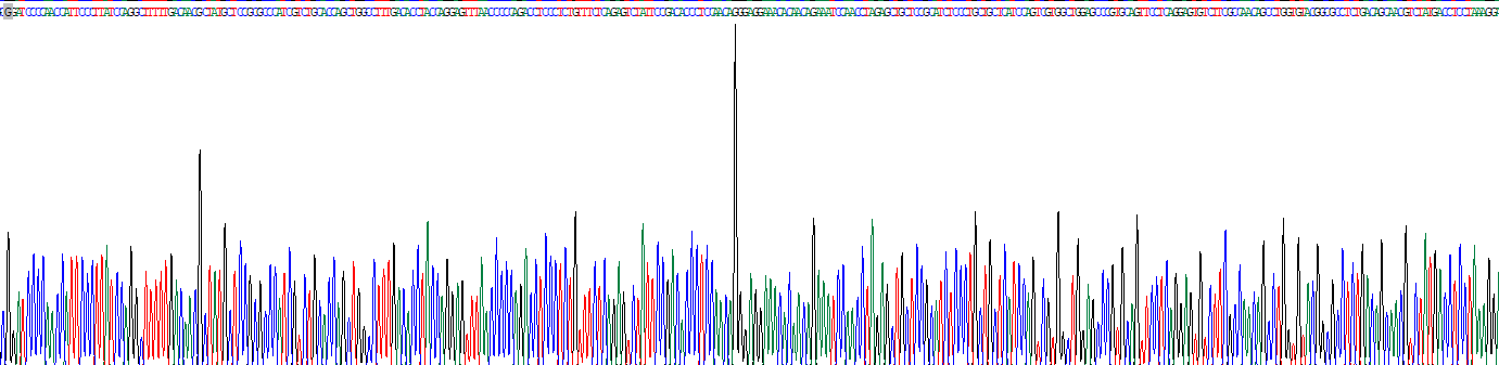 生长激素(GH)重组蛋白