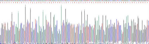 抑瘤素M(OSM)重组蛋白
