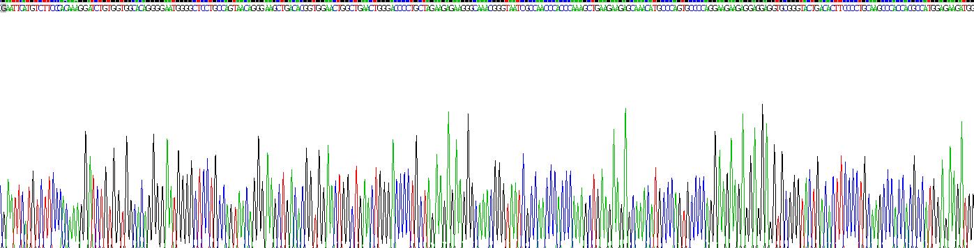 脂聯(lián)素受體1(ADIPOR1)重組蛋白