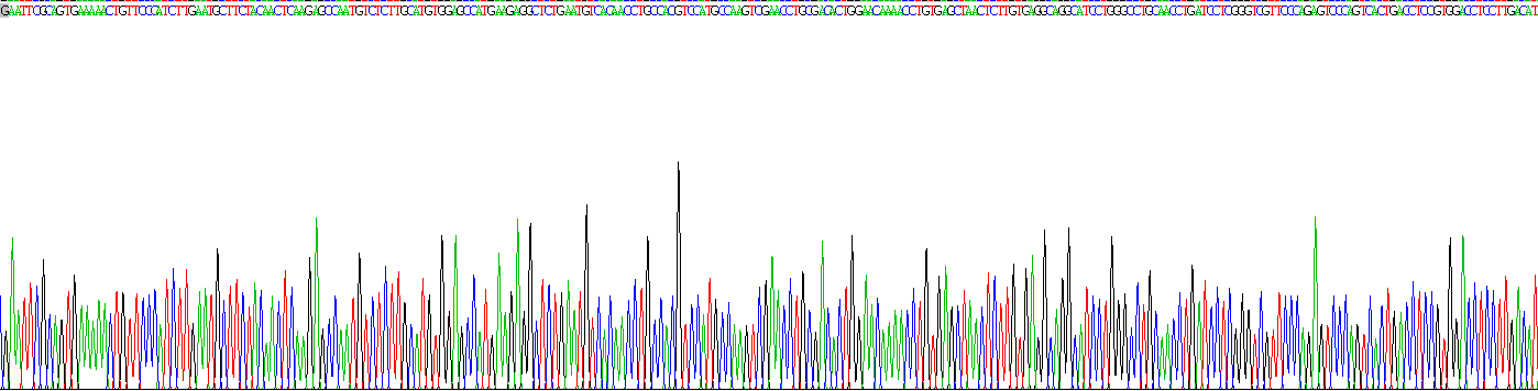 白介素2受体β(IL2Rb)重组蛋白