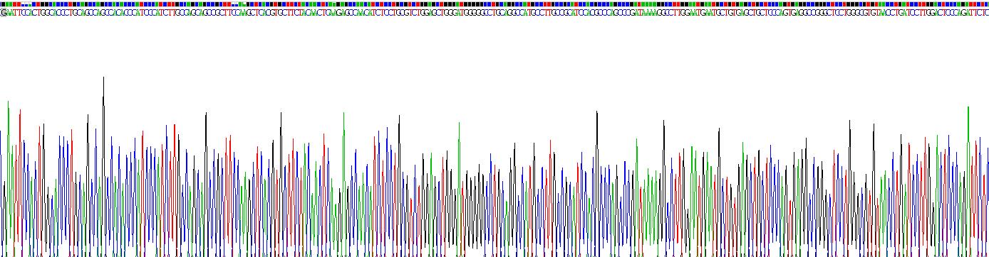 白介素2受体β(IL2Rb)重组蛋白
