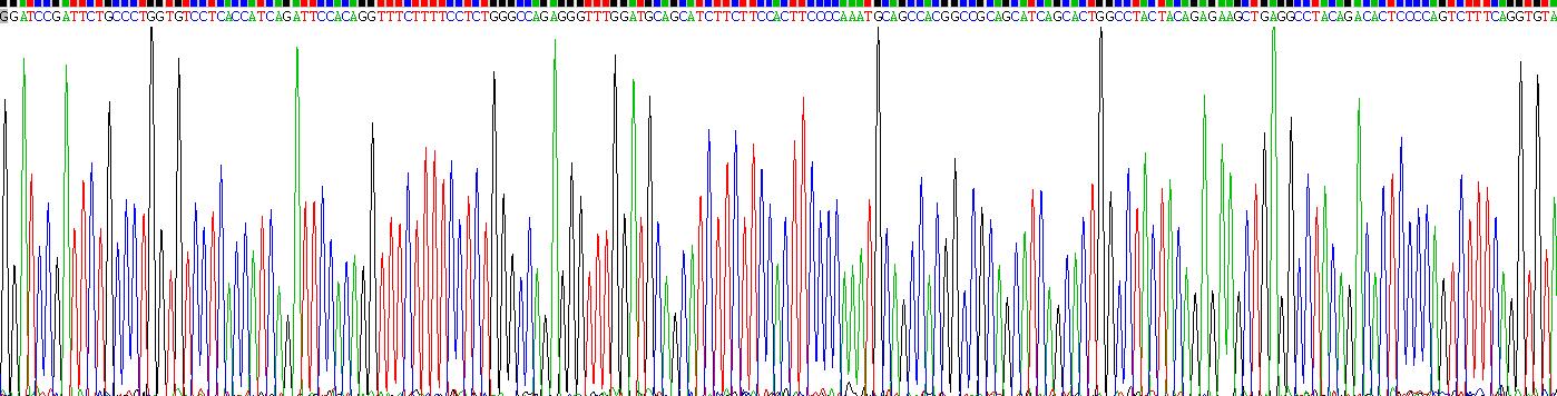 GATA结合蛋白1(GATA1)重组蛋白