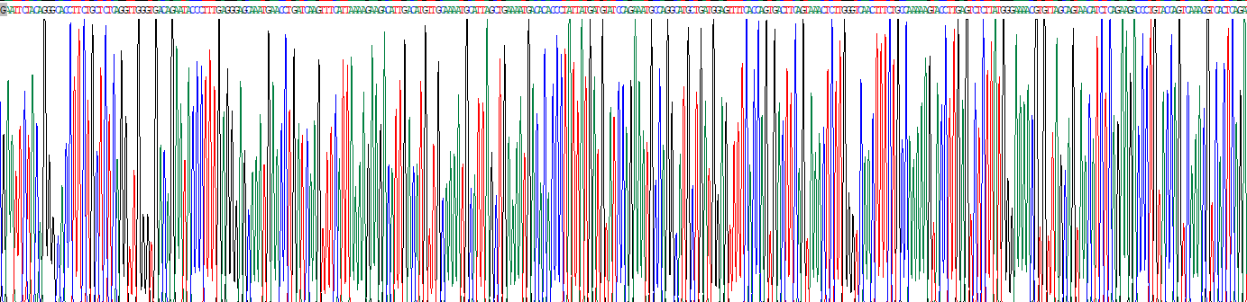血管活性肠肽(VIP)重组蛋白