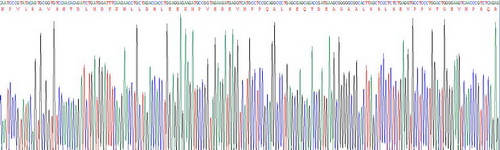 氨基端前心鈉肽(NT-ProANP)重組蛋白