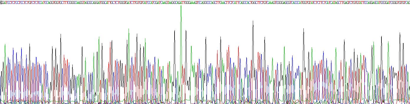 谷胱甘肽S转移酶μ1(GSTM1)重组蛋白