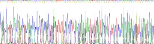 α1-酸性糖蛋白(a1AGP)重组蛋白
