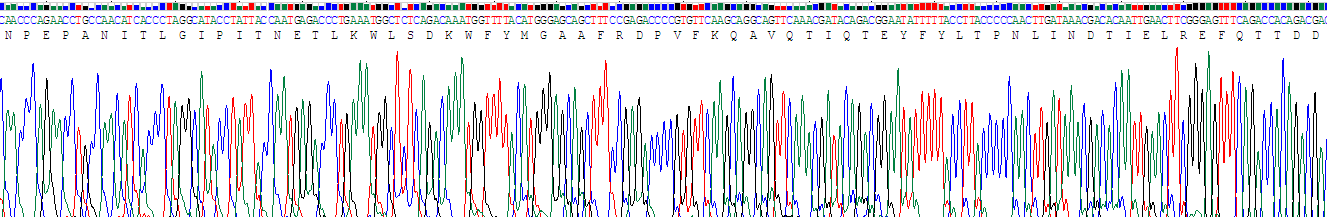 α1-酸性糖蛋白(a1AGP)重组蛋白