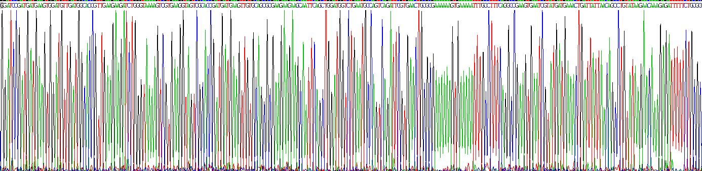 90kDa热休克蛋白β1(HSP90b1)重组蛋白