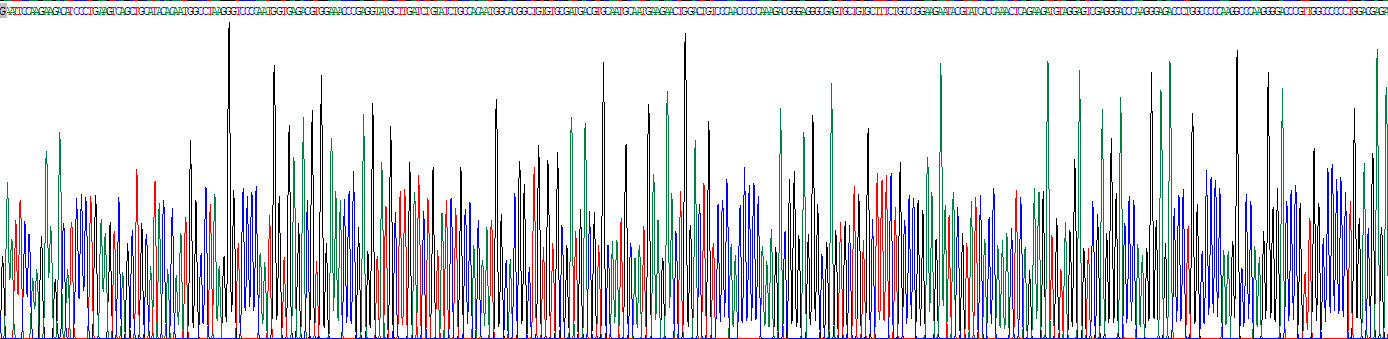 Ⅰ型前胶原氨基端原肽(PINP)重组蛋白