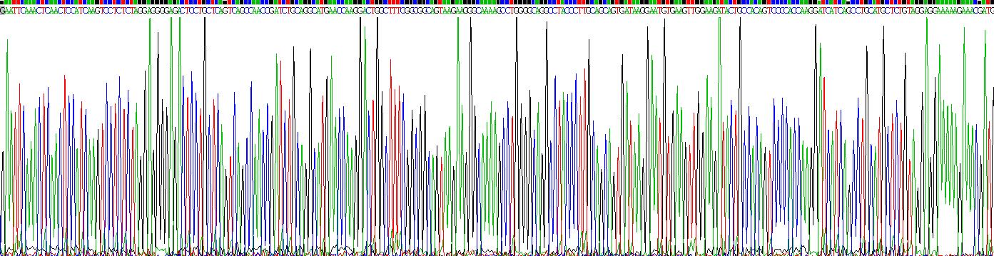 Dickkopf相关蛋白2(DKK2)重组蛋白