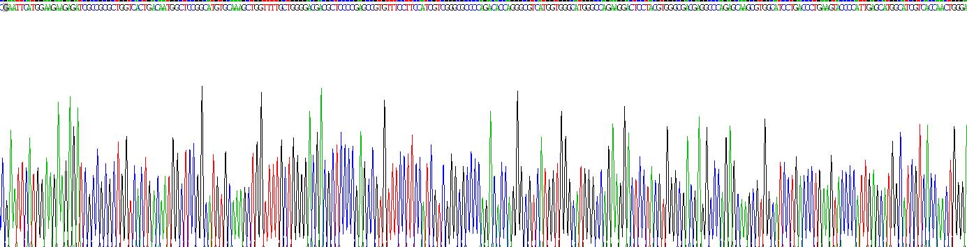 肌动蛋白γ1(ACTG)重组蛋白