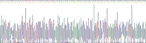 甘露糖结合蛋白(MBL)重组蛋白