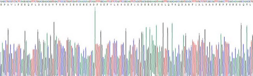 钙网蛋白(CALR)重组蛋白