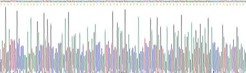 钙网蛋白(CALR)重组蛋白