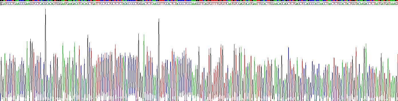 白介素2受体γ(IL2Rg)重组蛋白