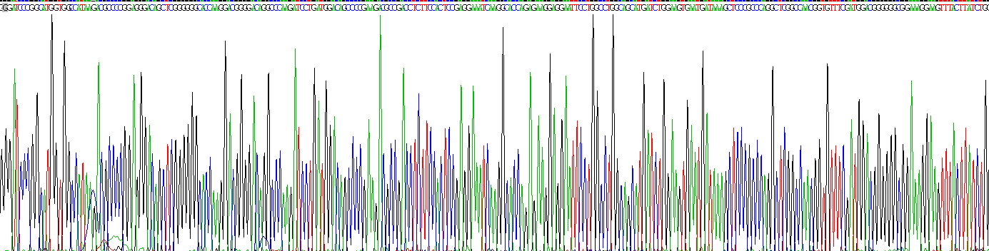 AMP激活蛋白激酶β1(PRKAb1)重组蛋白
