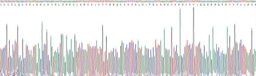 硒蛋白P1(SEPP1)重组蛋白