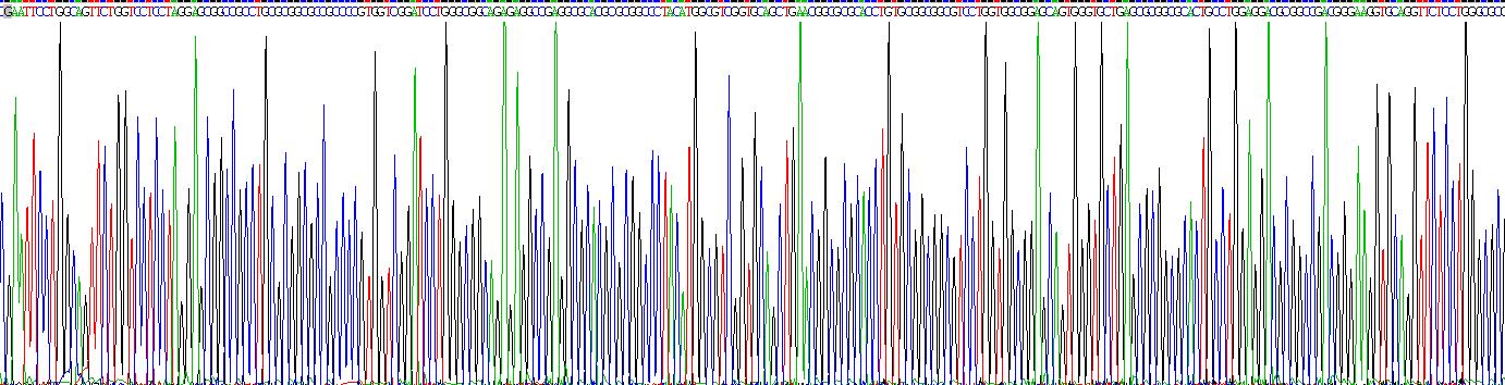 补体因子D(CFD)重组蛋白