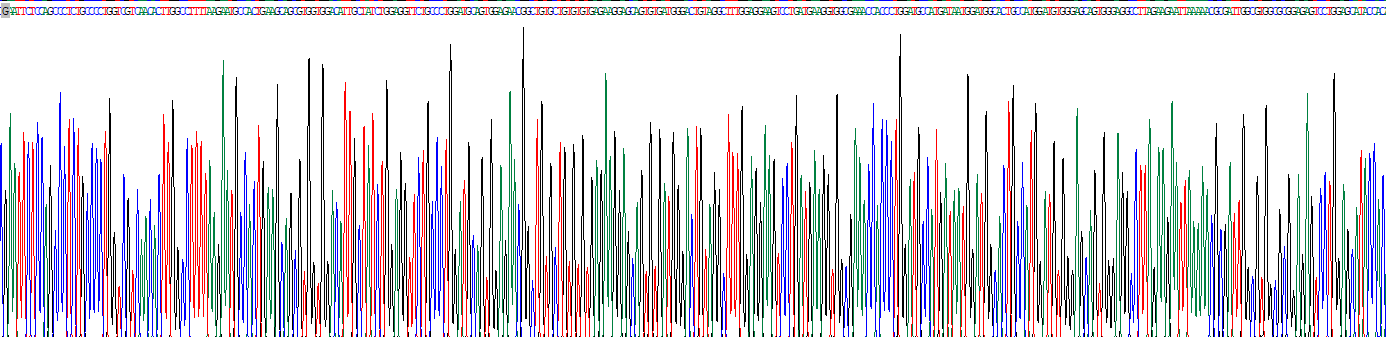 天冬酰胺氨基葡萄糖酶(AGA)重組蛋白
