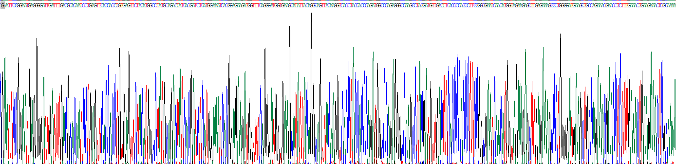 赖氨酸tRNA合成酶(KARS)重组蛋白