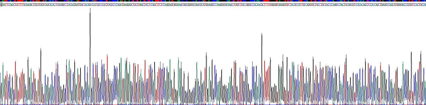 前蛋白转化酶枯草溶菌素9(PCSK9)重组蛋白