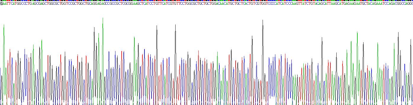 囊泡单胺转运蛋白2(VMAT2)重组蛋白