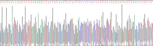 膜联蛋白A1(ANXA1)重组蛋白