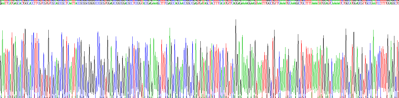 醛脫氫酶9家族成員A1(ALDH9A1)重組蛋白