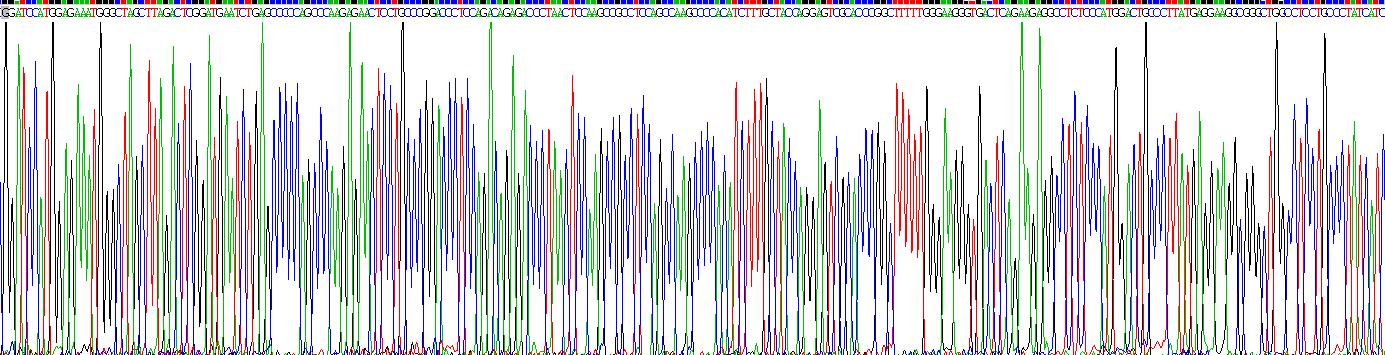 转化受体电位阳离子通道亚家族V成员1(TRPV1)重组蛋白
