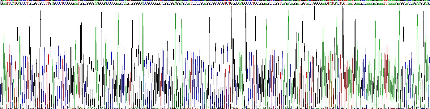 细胞因子信号转导抑制因子2(SOCS2)重组蛋白