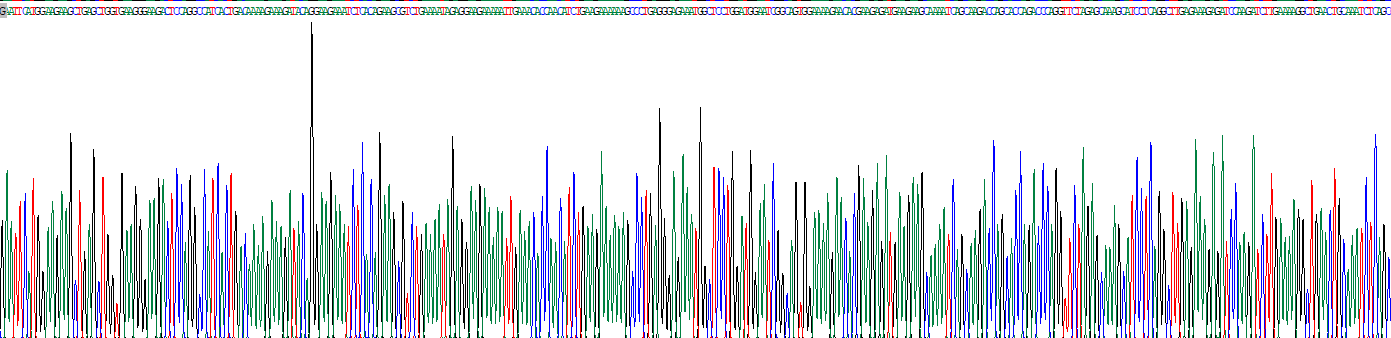 Palmdelphin蛋白(PALMD)重組蛋白