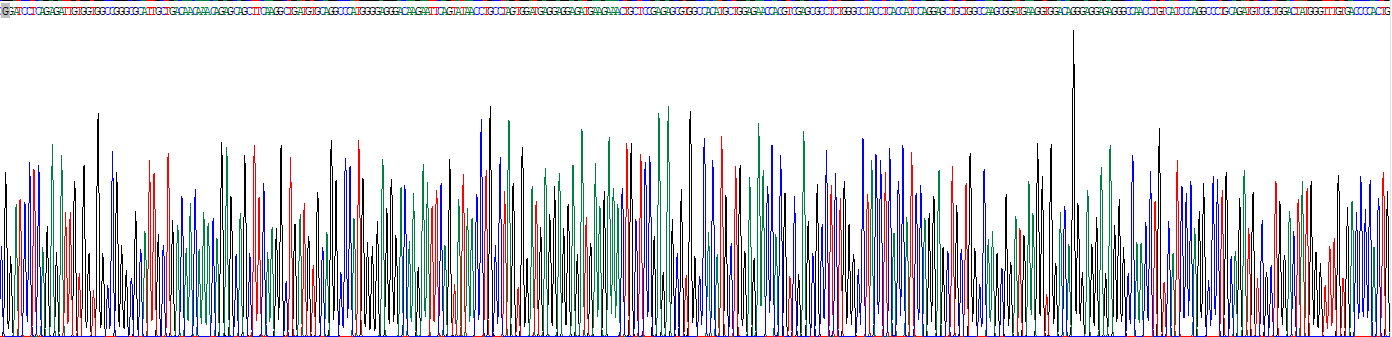 中间α-球蛋白抑制因子H1(ITIH1)重组蛋白