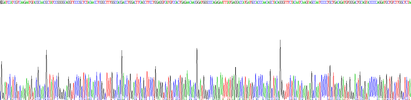 中间α-球蛋白抑制因子H1(ITIH1)重组蛋白